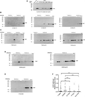 Different reactive profiles of calmodulin in the CSF samples of Chinese patients of four types of genetic prion diseases